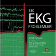 150 Soruda EKG Problemleri                                                                                                                                                                                                                                     
