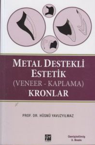Metal Destekli Estetik (Veneer - Kaplama) Kronlar                                                                                                                                                                                                              