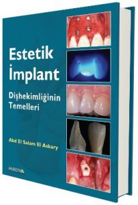 Estetik İmplant                                                                                                                                                                                                                                                