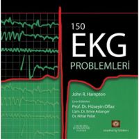 150 Soruda EKG Problemleri                                                                                                                                                                                                                                     
